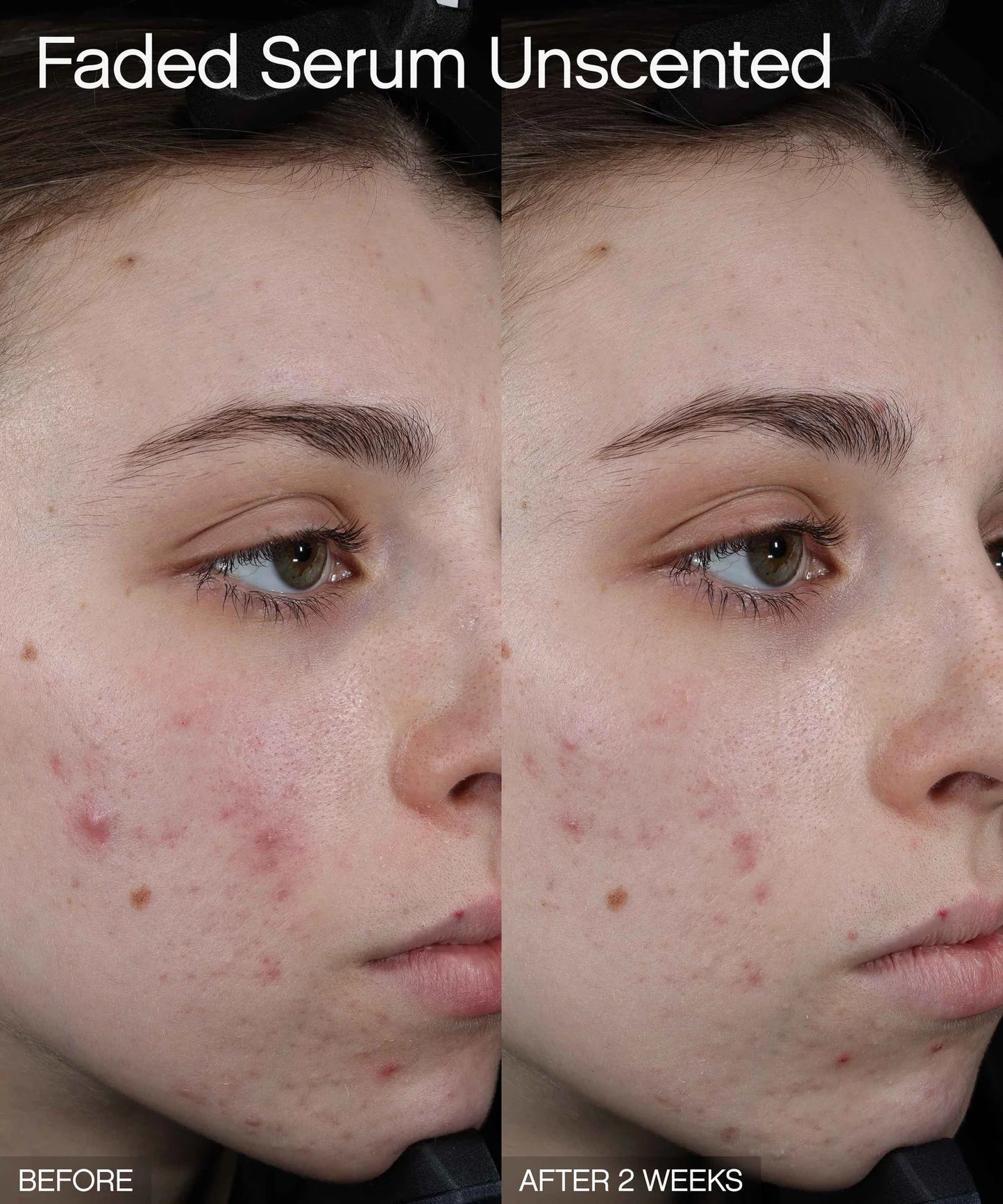 Topicals Faded Serum for Dark Spots & Discoloration