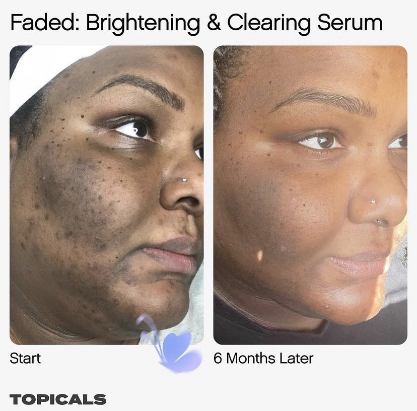 Topicals Faded Serum for Dark Spots & Discoloration