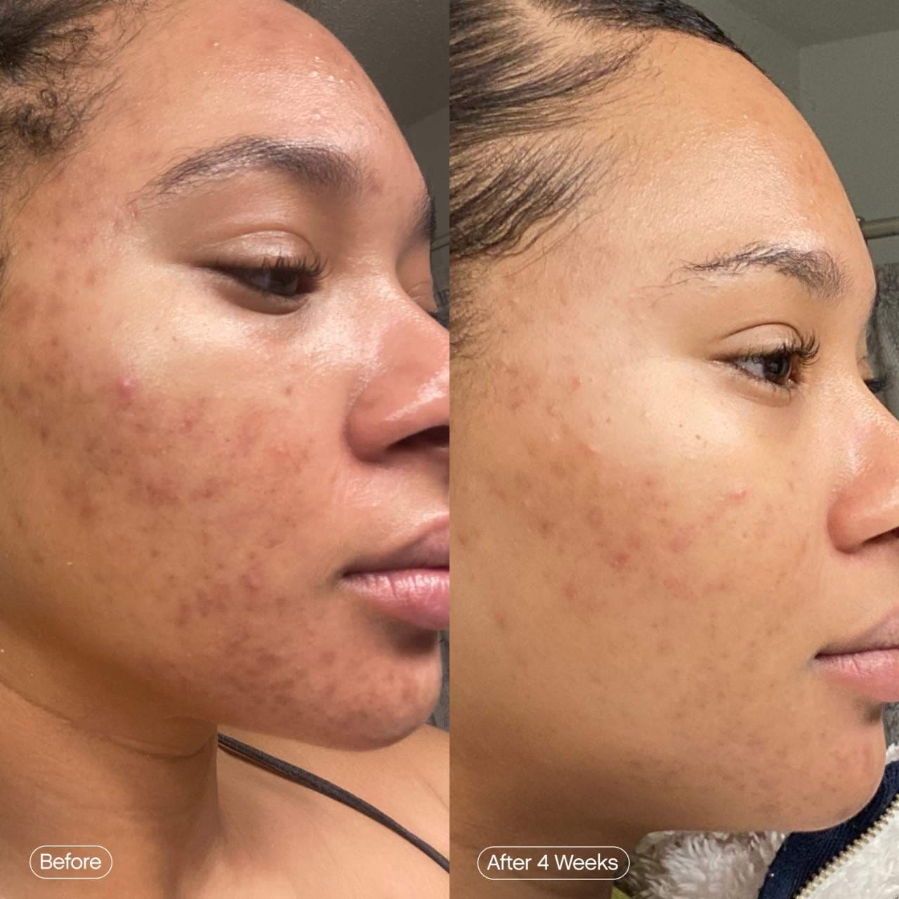 Topicals Faded Serum for Dark Spots & Discoloration