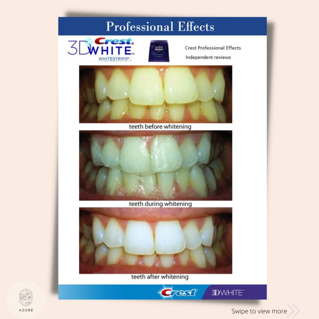 Crest 3D Whitestrips Professional Effects Teeth Whitening Strip Set, 5 Treatments