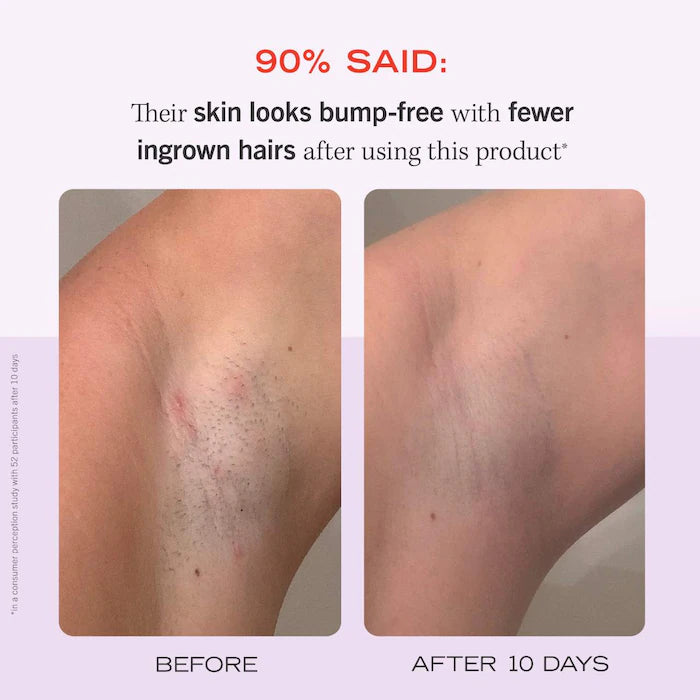 First Aid Beauty Ingrown Hair Pads with BHA & AHA