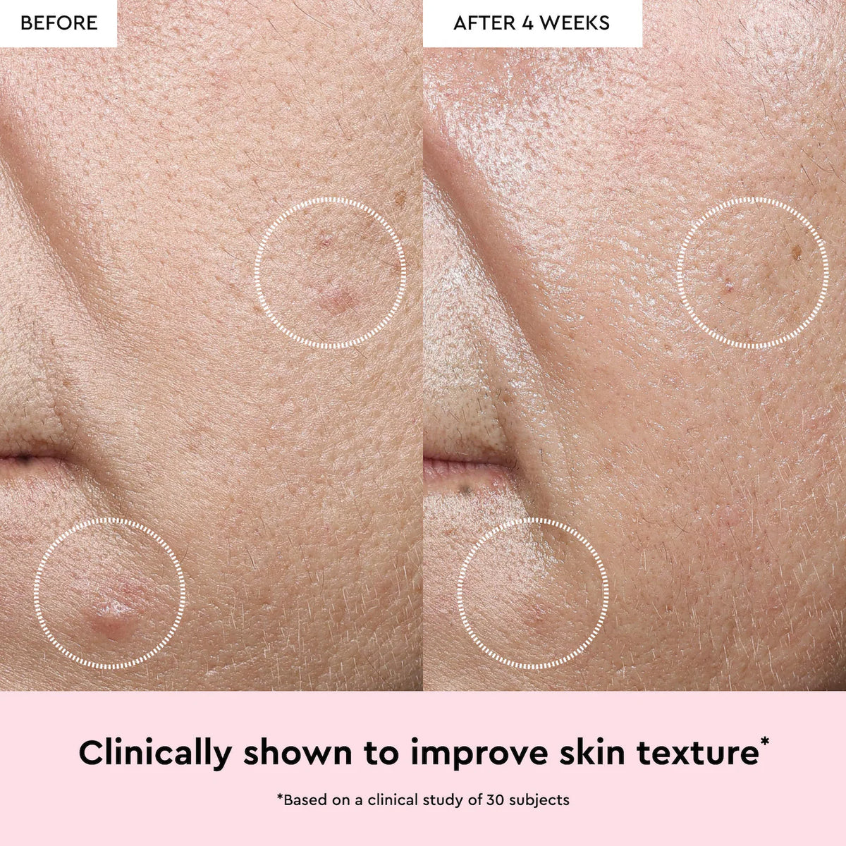 Glow Recipe Watermelon Glow Niacinamide Dew Drops Serum
