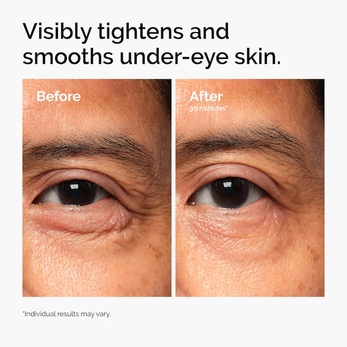 The Ordinary Lacto-PDRN* 4% + B9 Eye Cream