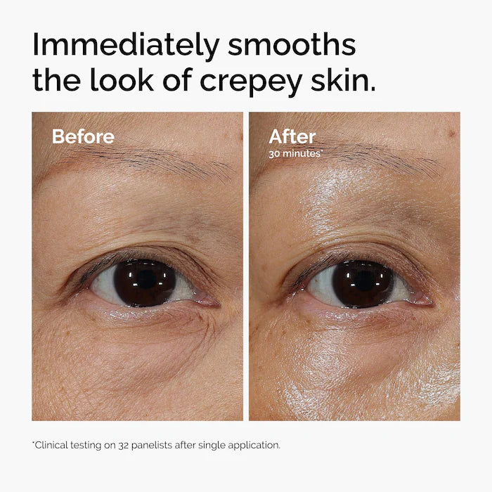 The Ordinary Lacto-PDRN* 4% + B9 Eye Cream